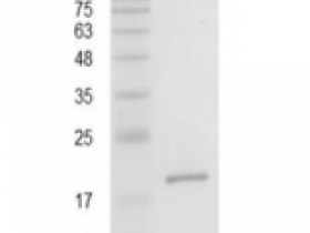 重组猪IL17A/白介素17A,无动物源&无载体蛋白