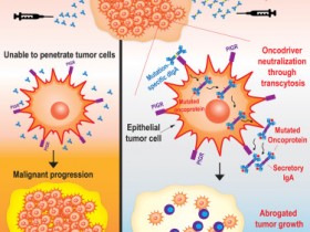Immunity 二聚体IgA (dIgA)靶向细胞内癌蛋白可促进细胞质的排出和上皮癌的免疫介导控制