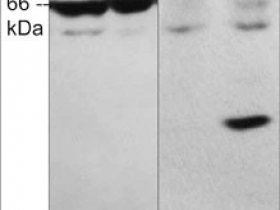 Phosphosolutions推出AIFM1 (Ser-116)磷酸化特异性抗体