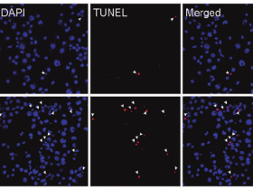 《中国药理学报》STAT3或FOXO1是参与H2O2诱导的N2a细胞凋亡的O-GlcNAc糖基化的潜在靶点
