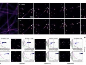 Nature Methods:基础模型用于基于荧光显微镜的通用图像复原
