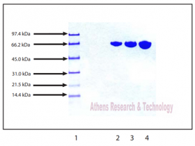 Athens Research & Technology人血浆转铁蛋白(Transferrin (HOLO), Human Plasma)