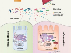 Cell Metabolism:TNF通过损害肠道胆汁酸耐受导致结肠炎恶化和英夫利西单抗反应受限