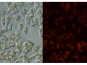 BioPAL USPIOs(超顺磁性氧化铁颗粒):用于MRI的细胞标记和追踪产品