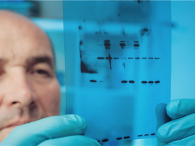 Tymora pIMAGO:一种新颖的、非抗体的、高效且安全的产品