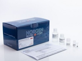 外泌体RNA纯化试剂盒-分离所有大小的外泌体和细胞外囊泡RNA