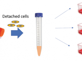 经验分享-细胞消化与传代