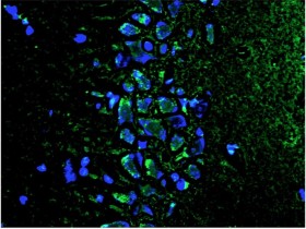 Biosensis 示踪试剂:退化神经元、淀粉样斑块以及正常和致病的髓鞘检测