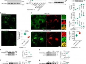 《自然》石胆酸通过结合TULP3激活sirtuin和AMPK来减缓衰老过程