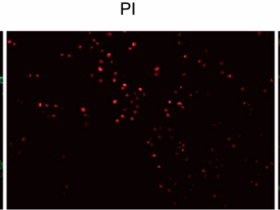 Abbkine Annexin V-AbFluor 488/PI双染细胞凋亡检测试剂盒实验操作流程