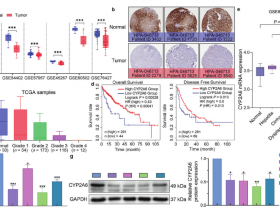 《中国药理学报》揭示CYP2A6通过抑制SRC/Wnt/β-Catenin通路抑制肝癌