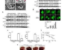 首都医科大学报道:治疗对乙酰氨基酚过量造成肝损伤的新策略