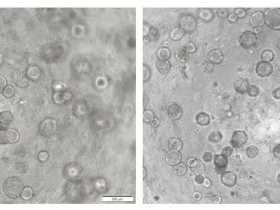 3D细胞培养助力新冠研究(上)——气道类器官的建立方法