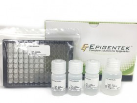 基于686篇文献验证的m6A定量金标准—EpiQuik™ m6A RNA 甲基化定量试剂盒