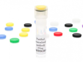 超值高性价比抗人IL-1β单克隆抗体(7P10),生物素