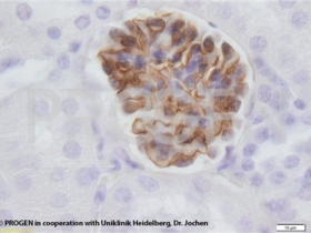 PROGEN抗Nephrin豚鼠多克隆血清,适用于ICC/IF、IHC和WB