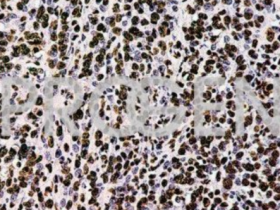 PROGEN抗核糖核蛋白小鼠单克隆抗体,58-15,纯化方案