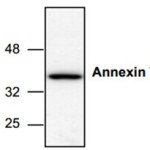 Annexin V 与细胞凋亡的不解之缘