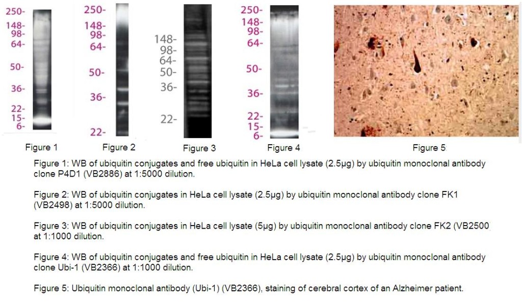 泛素Ubiquitin抗体套装—实现游离泛素/单泛素化蛋白/多泛素化蛋白以及多泛素链的检测