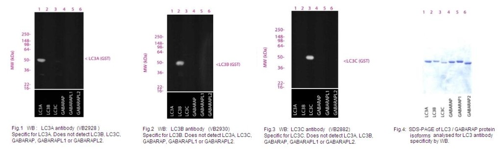 LC3抗体套装—同时检测3种不同自噬标记物LC3亚型（LC3A、LC3B、LC3C）