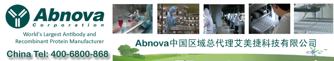 登革熱(Dengue virus)IgG/IgM ELISA試劑盒與登革熱抗體工具