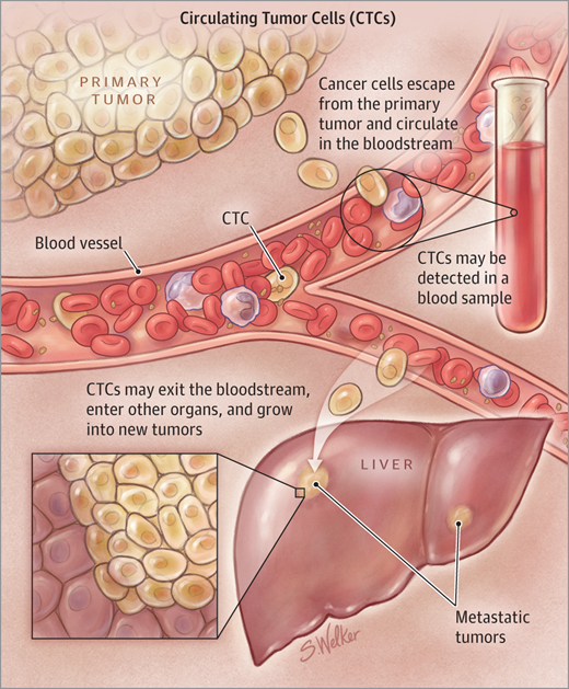 CTCs