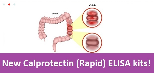 calprotectin-fecal-rapid-kit