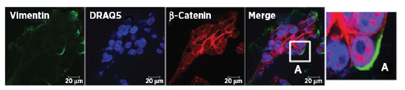 vimentin-antibody