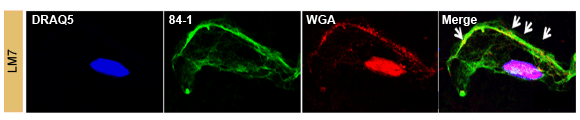 vimentin-antibody