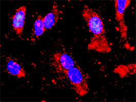 Antibody abonova