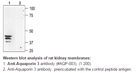 Anti-Aquaporin3-wb