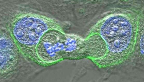 eLife-cancer-cell