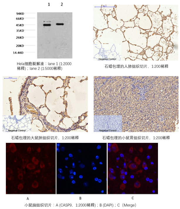 CASP9-results