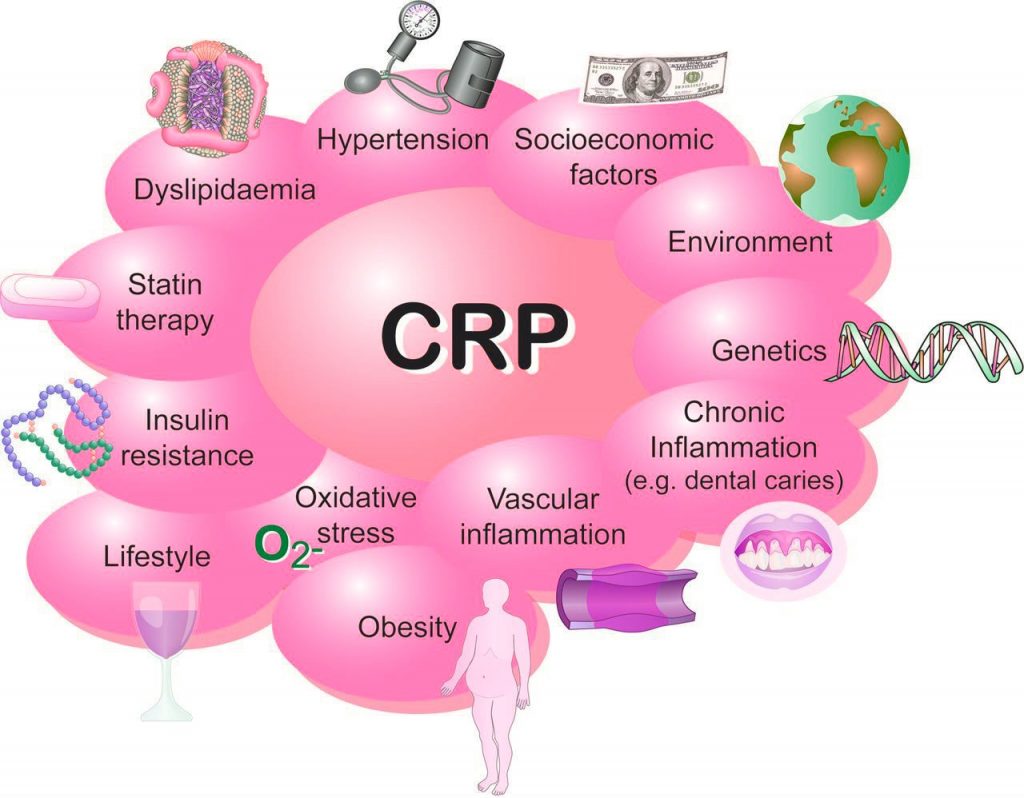 C反应蛋白/CRP 临床应用