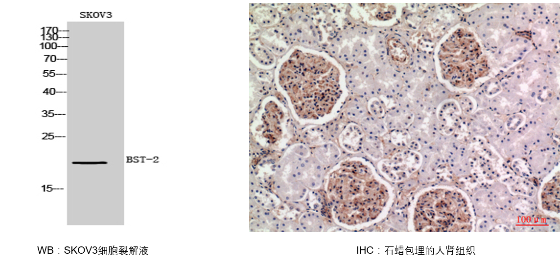 Tetherin/CD317抗体数据和结果