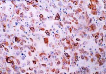 Immunohistochemistry