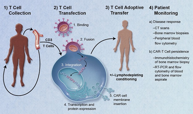 CAR-T-cell-therapy