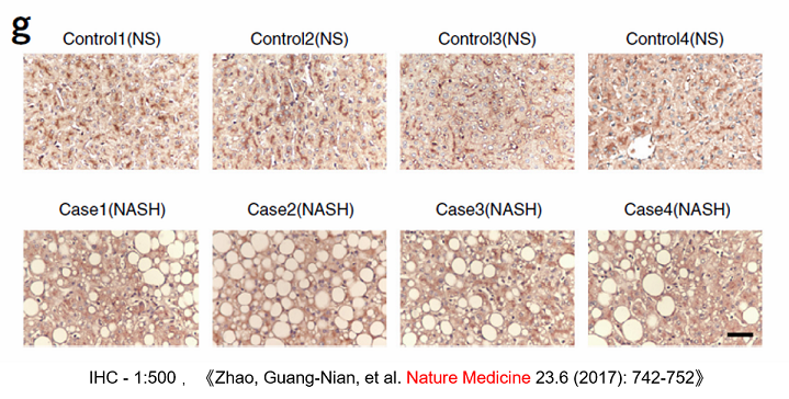 IHC HRP标记山羊抗兔二抗