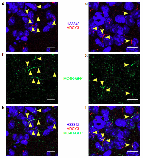 MC4R和ADCY3在PVN神经元纤毛上的共定位