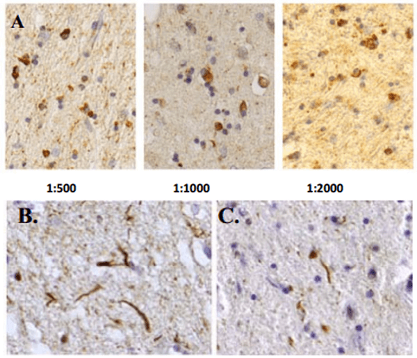 泛素抗体IHC