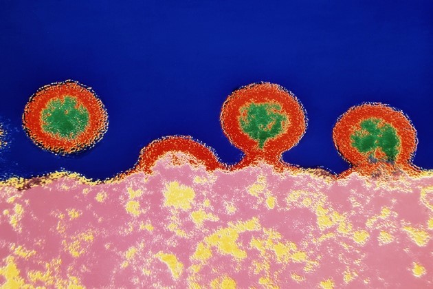 血液中检测出HIV病毒