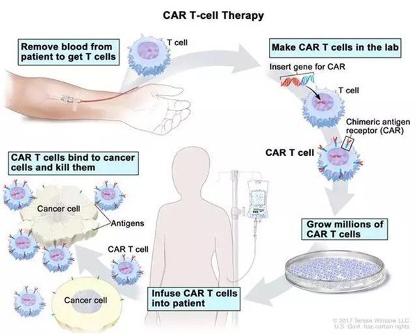 CAR-T 疗法,诺华制药