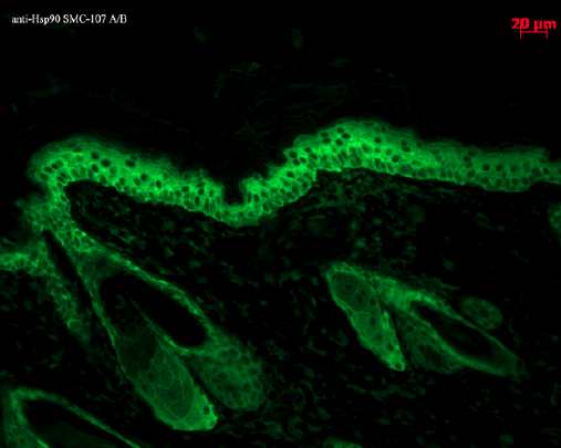 小鼠抗Hsp90单克隆抗体对小鼠背部皮肤的免疫组化分析