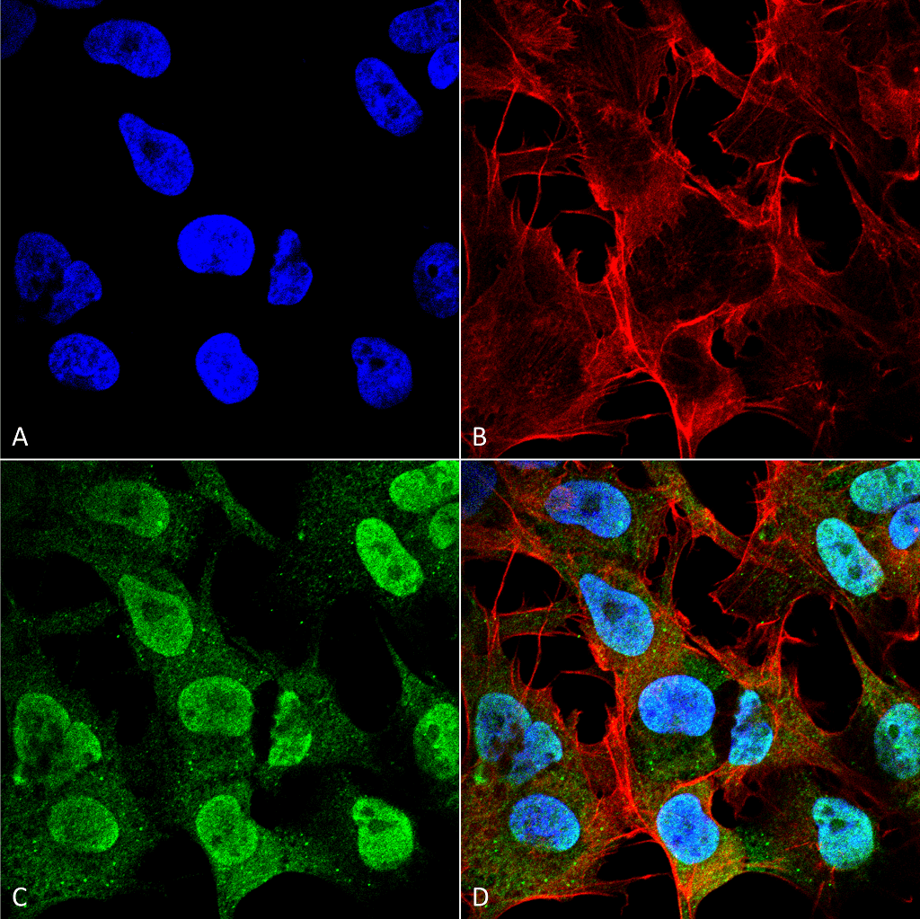 小鼠抗Alpha Synuclein单克隆抗体 (SMC-533)