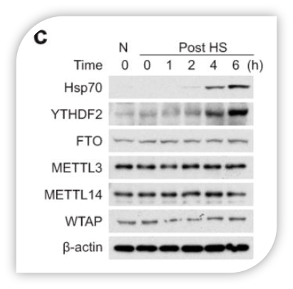 METTL3 - WB