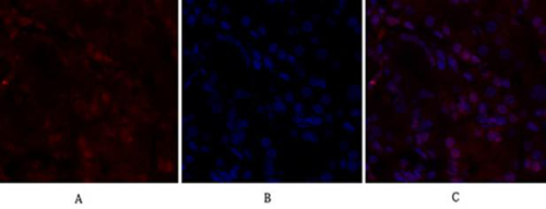 BRCA1：红色，人胃组织