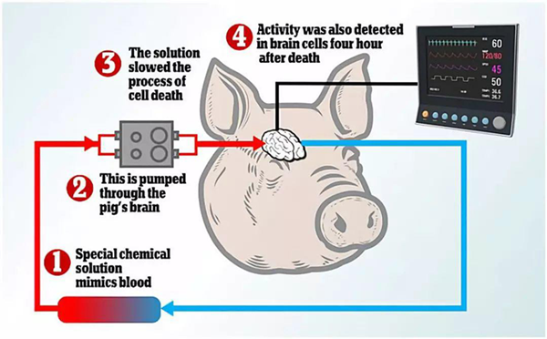 灌注技术平台Brain Ex可以恢复死猪大脑的部分循环和细胞功能