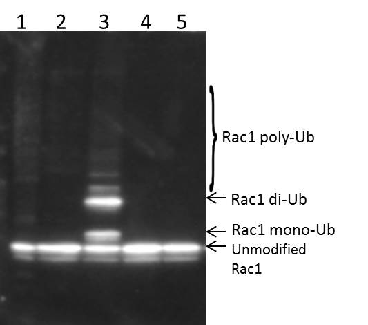 Signal-Seeker™试剂盒研究Rac1蛋白的单泛素化和多元泛素化
