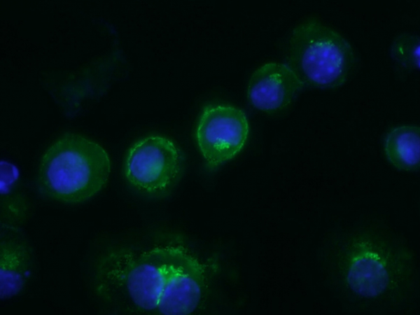 克隆号 Sa14-2抗体免疫荧光