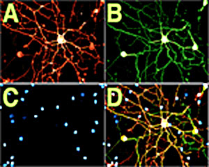 大鼠背根神经节（DRG）p75NTR的免疫荧光检测